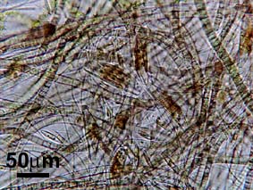 filaments blue green algae