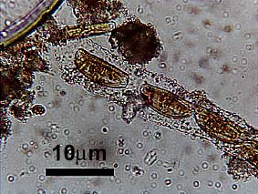 diatom string